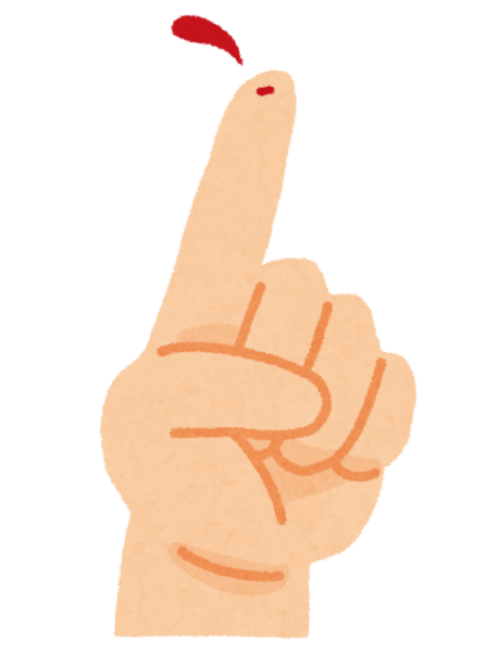 身近な事故、特に手指の怪我について対策と受診の目安のアイキャッチ画像